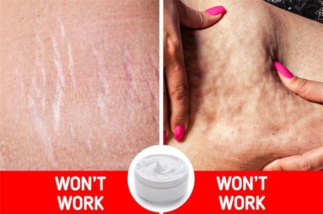 8 món mỹ phẩm bác sĩ da liễu khuyên bạn không nên mua - Ảnh 7. 8 món mỹ phẩm bác sĩ da liễu khuyên bạn không nên mua - Ảnh 7.