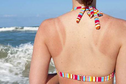 Bạn đã biết cách để làn da không bắt nắng?