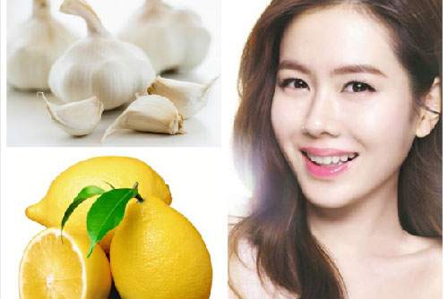 Cách trị mụn từ củ tỏi cực hiệu quả bạn đã biết chưa?