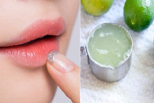 2 mẹo 'hô biến' môi thâm thành căng mọng, hồng hào