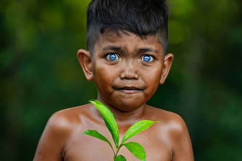 Bộ lạc mắc hội chứng hiếm gặp khiến màu mắt xanh như biển sâu