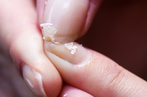 5 lý do bạn nên giảm lượng muối ngay hôm nay