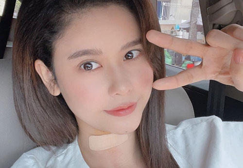 Trương Quỳnh Anh vừa phẫu thuật tuyến giáp, hé lộ tình hình hiện tại