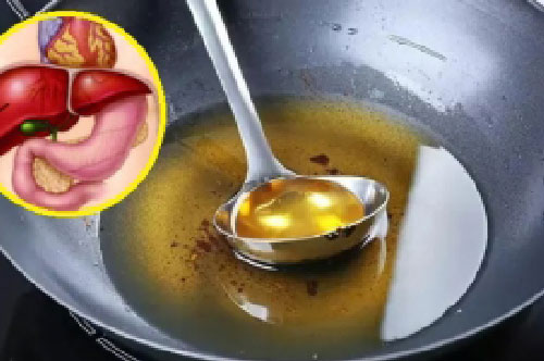 5 thói quen sử dụng dầu ăn khiến gan thận nát bấy, đặc biệt là số 2 nhiều người Việt vẫn làm mỗi ngày