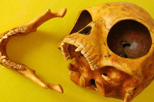 Những hộp sọ kỳ lạ nhất từng được phát hiện trong lịch sử