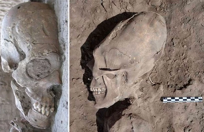 Những hộp sọ kỳ lạ nhất từng được phát hiện trong lịch sử - Ảnh 4.