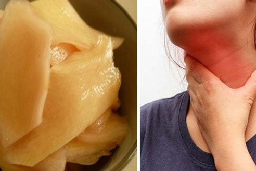 Món ăn chữa dứt điểm chứng trào ngược dạ dày, ngăn ngừa ung thư thực quản