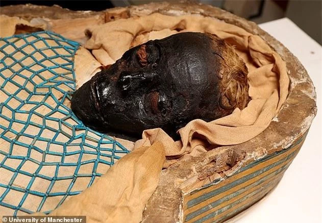 Bí ẩn xác ướp nổi tiếng được giải mã: Cái chết đau đớn của người phụ nữ cách đây 2.600 năm ảnh 1