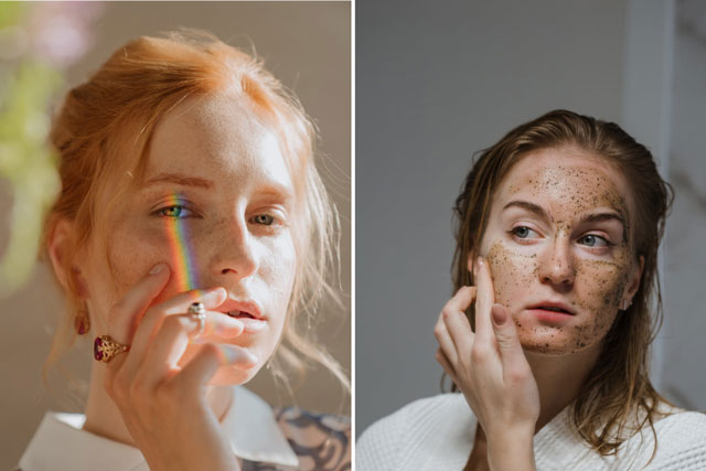 Mẹo chăm sóc da tàn nhang ngày Hè để gìn giữ nhan sắc xinh đẹp tỏa sáng