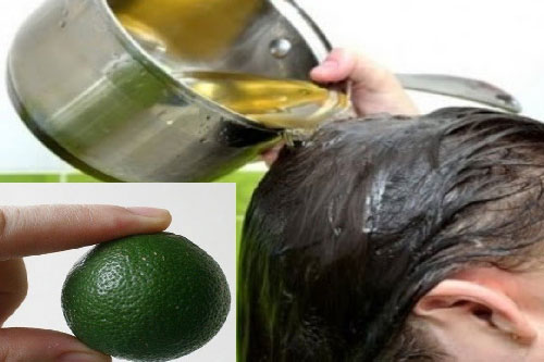 3 cách làm sạch gàu nhanh chóng không mất nhiều thời gian