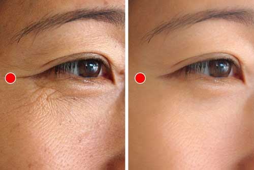 'Đánh bay' vết chân chim chỉ bằng bài tập 1 phút của người Nhật