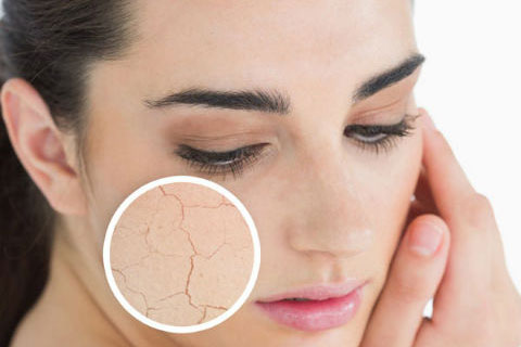 Dấu hiệu nhận biết làn da bạn bị thiếu nước