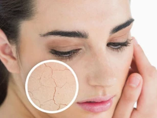 Dấu hiệu nhận biết làn da bạn bị thiếu nước