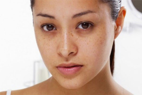 4 cách chữa thâm mắt tại nhà bạn cần ghi nhớ