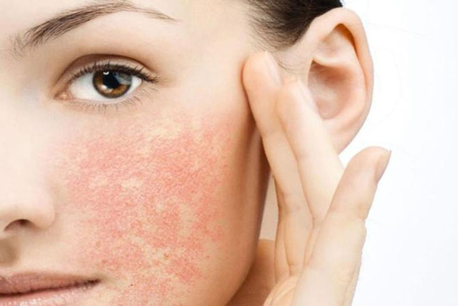 Thói quen khiến làn da nhạy cảm tổn thương