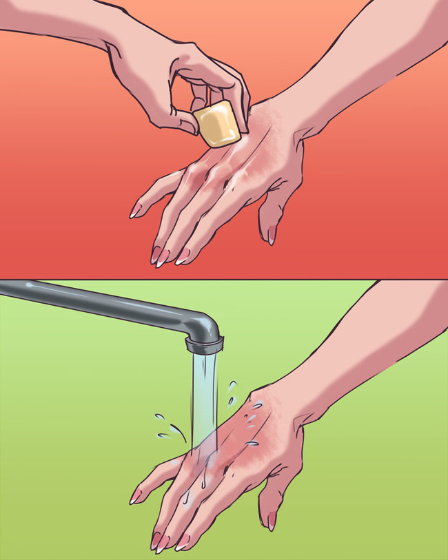 10 sai lầm khi sơ cứu, chăm sóc sức khỏe khiến bạn gặp nguy hiểm