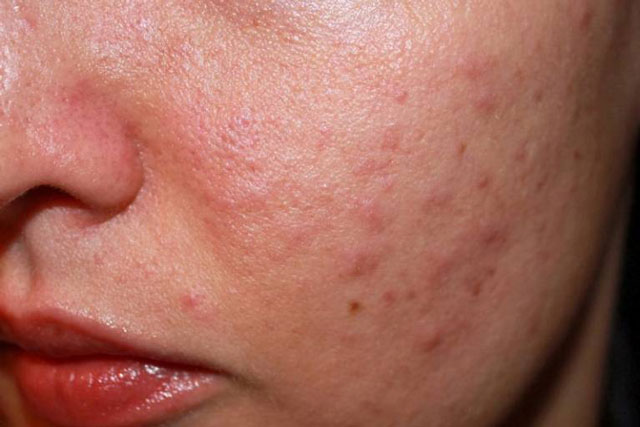 Dấu hiệu cho thấy bạn đang dùng sai mỹ phẩm