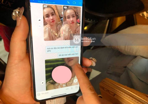 Hé lộ tin nhắn chồng cũ gửi "Cô Xuyến" Hoàng Yến sau cú đấm dã man, chi tiết ám chỉ nữ diễn viên thủ đoạn gây chú ý