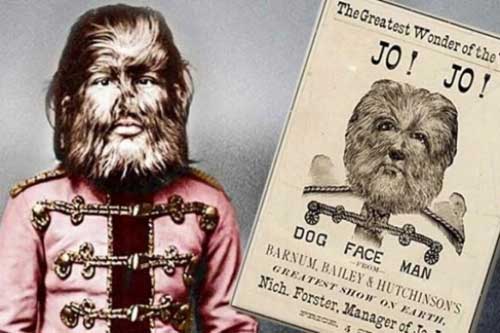 Chuyện về cậu bé “người sói” Nga từng chinh phục khắp nước Mỹ