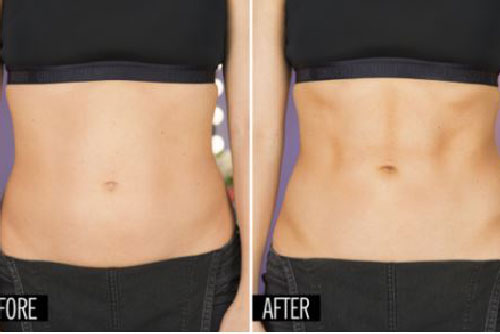 Mẹo giúp giảm cân tại nhà nhanh cho cô nàng lười