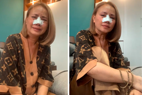 Hoàng Yến livestream khóc nức nở dù mũi đang băng bó, khẳng định nếu ngoại tình sẽ bị xe đâm