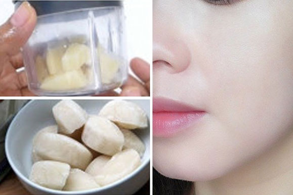 Da bị nám 20 năm cũng khỏi chỉ bằng củ khoai tây