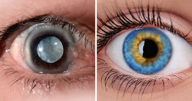 8 loại thực phẩm thông thường có tác dụng không ngờ trong việc chữa bệnh