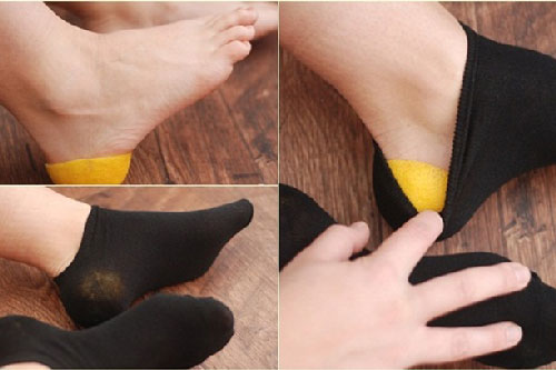 5 cách trị gót chân nứt nẻ cực đơn giản