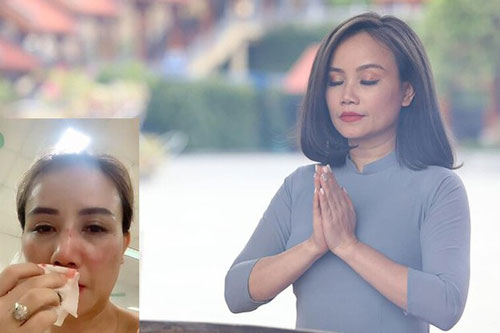 Không chỉ Hoàng Yến, nhiều sao Việt bị chồng đánh đập, bạo hành