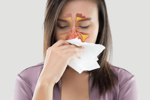 Cẩn trọng với bệnh viêm xoang cấp tính