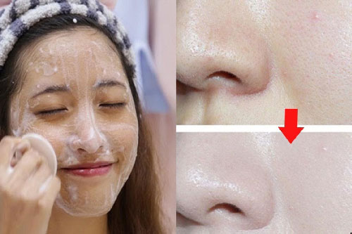 Đông đá sữa chua giúp làn da trắng hồng chỉ trong 7 ngày