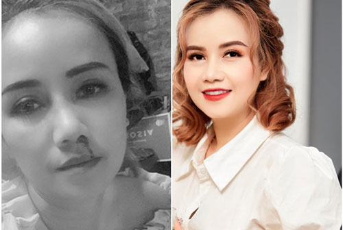 Bi kịch bị chồng bạo hành của nhiều sao Việt