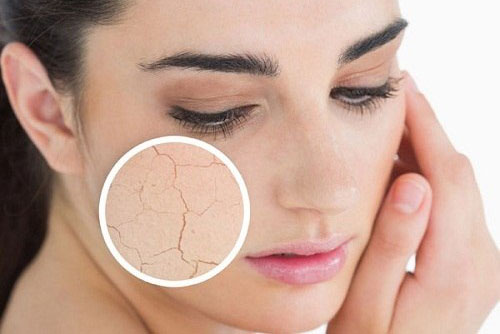 Thấy 4 dấu hiệu này bạn cần bổ sung nước cho da ngay