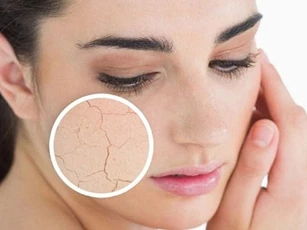 Thấy 4 dấu hiệu này bạn cần bổ sung nước cho da ngay