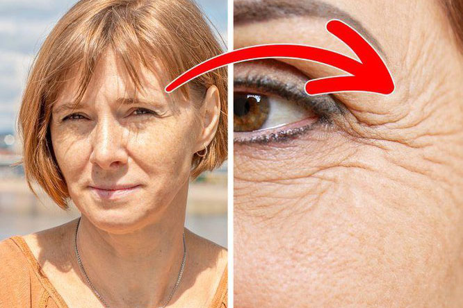 "Nghiện" smartphone có nguy cơ gây ra nếp nhăn sớm