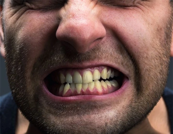 6 thói quen khiến răng bạn ố vàng - 6