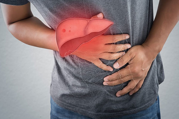 Thảo dược tốt cho người gan nhiễm mỡ