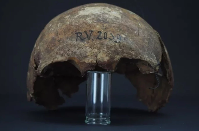 Hộp sọ của người đàn ông nhiễm bệnh dịch hạch cách đây 5.000 năm. (Ảnh: Đại học Kiel).