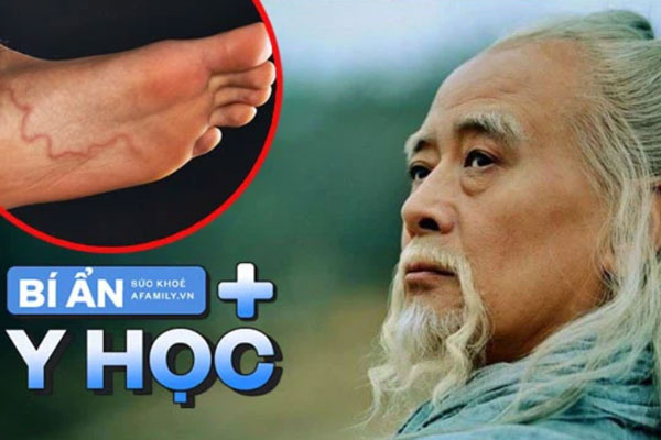 Bí ẩn "con rắn trong chân người" mà Hoa Đà phát hiện cách đây 2.000 năm, y học giải mã căn bệnh đáng sợ