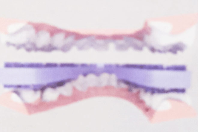 Bàn chải răng thông minh của bác sĩ Việt được Mỹ cấp bằng sáng chế