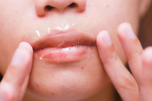 Không cần son dưỡng, môi vẫn hồng hào "vạn người mê"