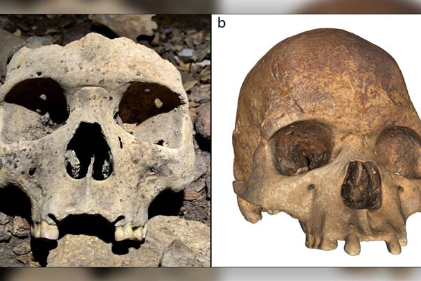 Thói quen làm đẹp đau đớn của người châu Phi cách đây 500 năm