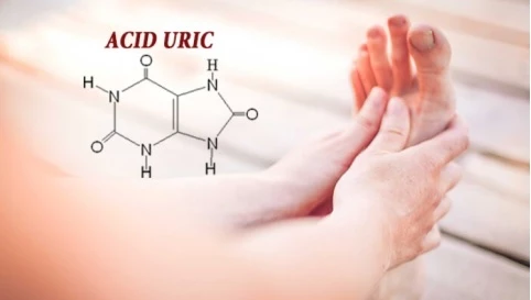 Acid uric trong máu tăng cao gây bệnh gout.