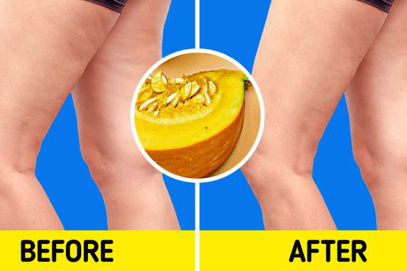 7 loại thực phẩm giúp ngăn ngừa da bị sần vỏ cam