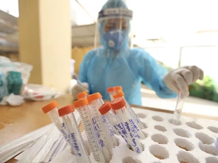 Sáng 3/8, có 3.578 ca mắc COVID-19, gần 7 triệu liều vaccine được tiêm tại Việt Nam