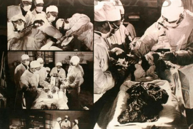 Chất độc tử thi là gì mà nó khiến mọi chuyên gia đều kinh hãi? - Câu chuyện có thật hé lộ điều kinh hoàng