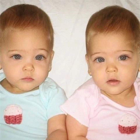 2 chị em từng được mệnh danh là “cặp song sinh xinh đẹp nhất thế giới”, được săn đón khi mới 6 tháng tuổi bây giờ ra sao? - Ảnh 1.
