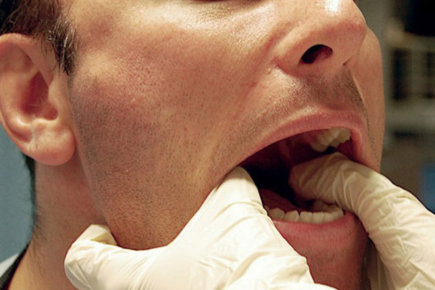 Chuyên gia chỉ cách phân biệt: Ung thư vòm họng với viêm họng, viêm amidan