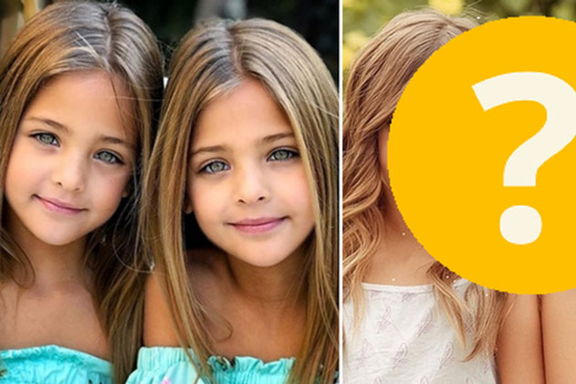 2 chị em từng được mệnh danh là “cặp song sinh xinh đẹp nhất thế giới”, được săn đón khi mới 6 tháng tuổi bây giờ ra sao?