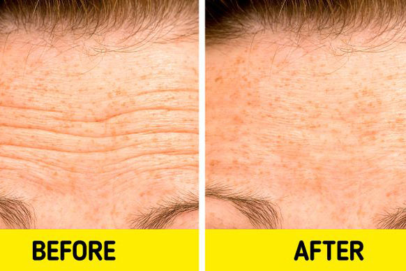 Những sản phẩm tự nhiên có thể giúp chị em đánh bay nếp nhăn trên trán